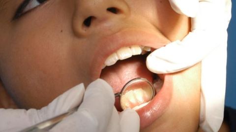 Conoce los factores que pueden provocar cáncer en cavidad oral